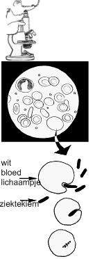 witte bloedlichaampjes en bacterie onder de microscoop