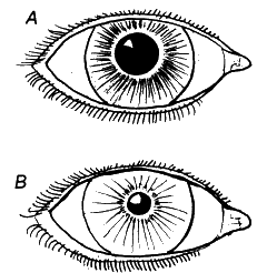 pupil reflex